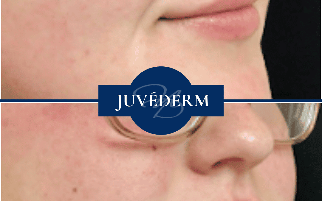 Botox In Hammond Louisiana