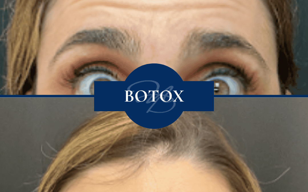 Botox In Madisonville Louisiana