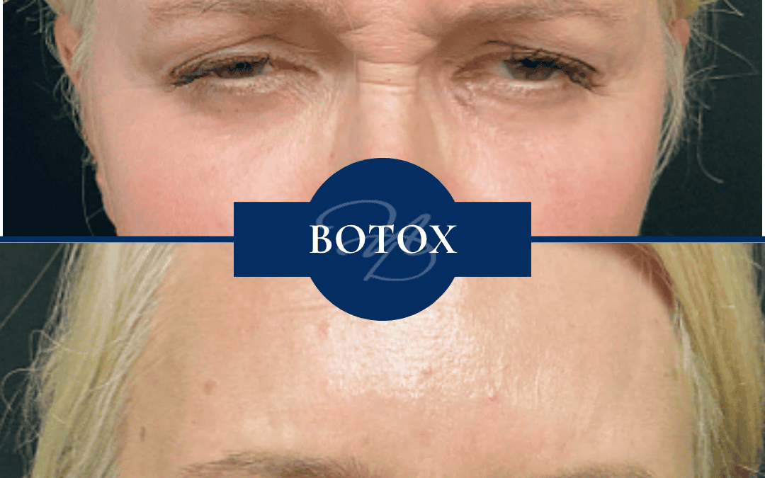 Cosmetic Dermatology In Hammond Louisiana