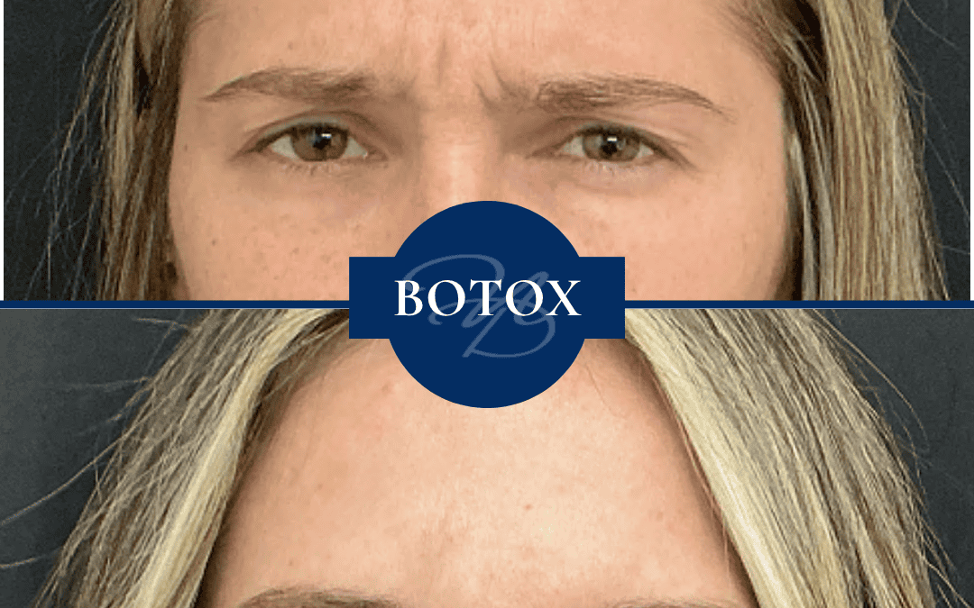 Cosmetic Dermatology In Madisonville Louisiana