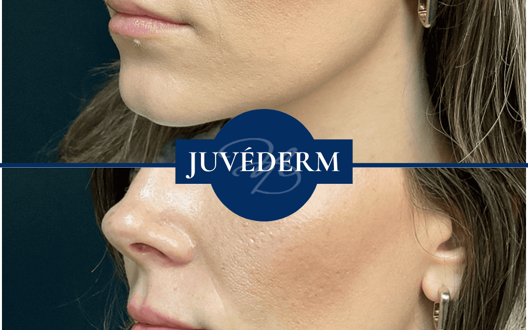 Fillers In Madisonville Louisiana