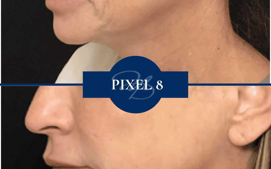 Radiofrequency In Hammond Louisiana