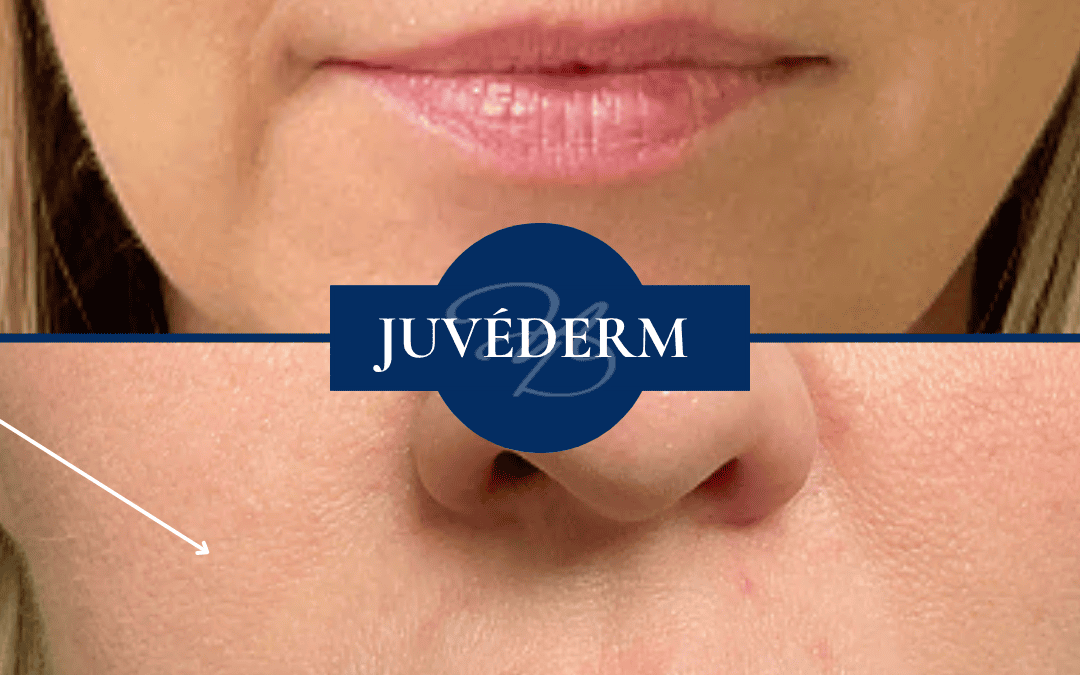 Radiofrequency In Madisonville Louisiana