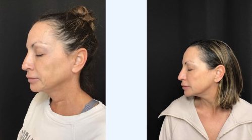 Medical-Dermatology-in-Madisonville-Louisiana-03-05-001-Pixel-8